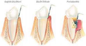 periodontoloji3